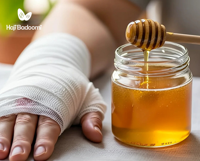 فواید عسل در بهبود زخم